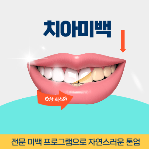 신촌치과 신촌역치아미백